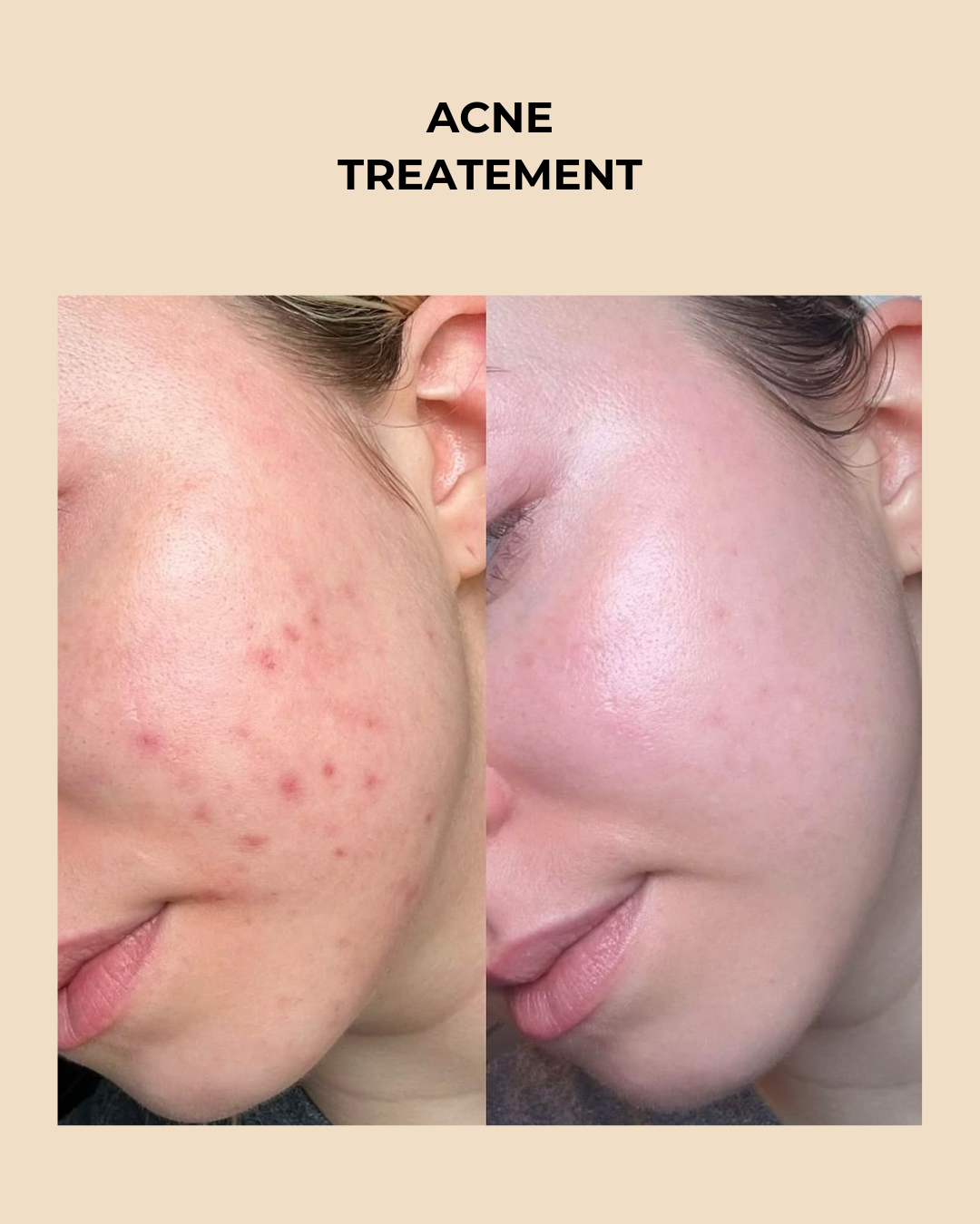 Premium  3-in-1 Wireless Laser Hair & Skin Device