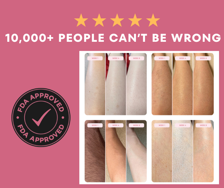 Advanced IPL Hair Laser Removal Device + Ultra Fast