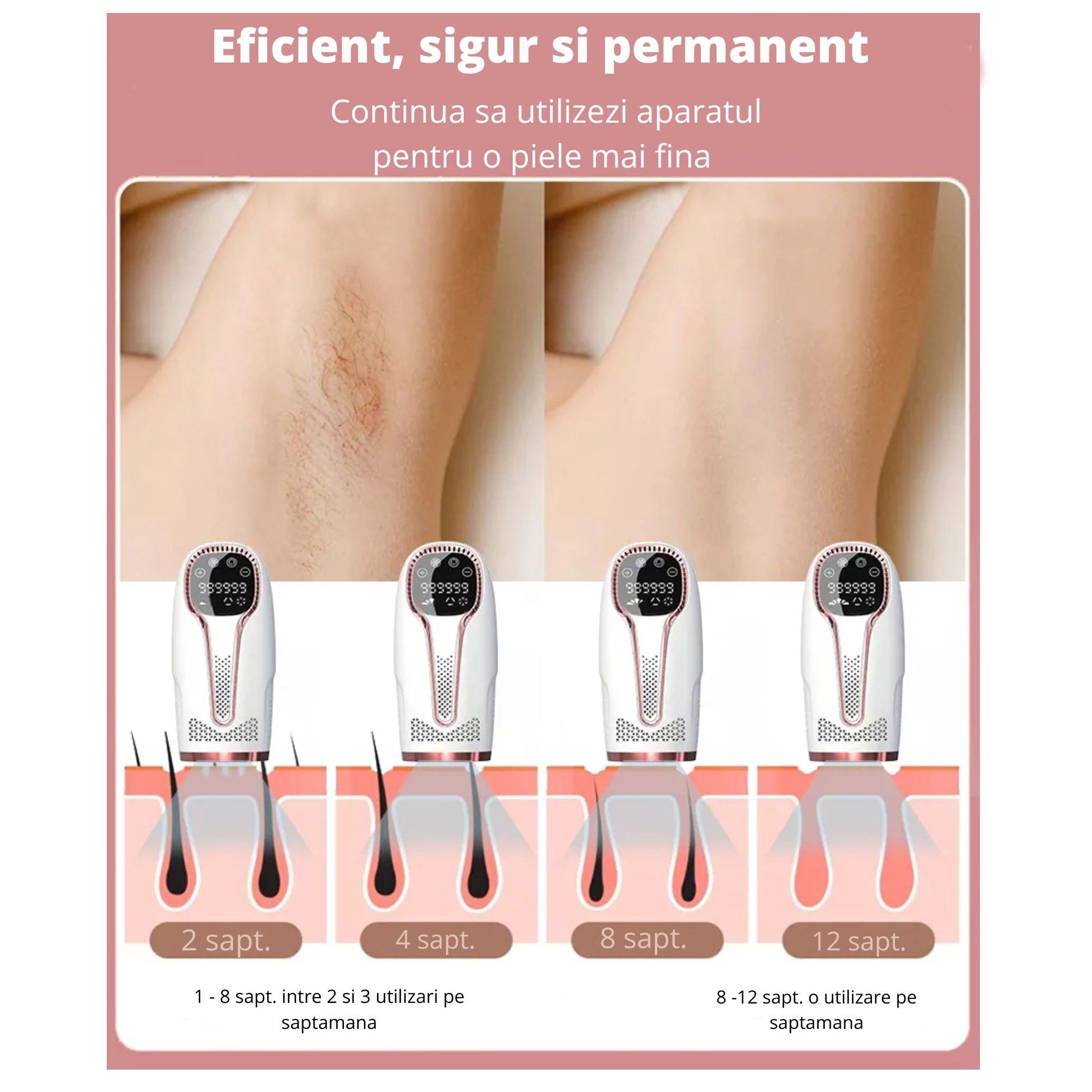 Painless & Permanent Hair Removal & Touch Screen Function